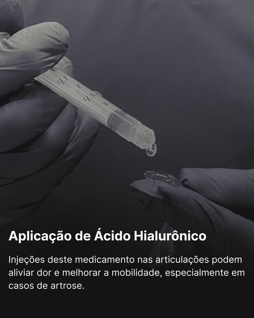 Aplicação de Ácido Hialurônico Novo